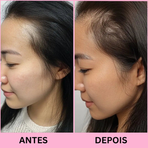 Escova de Terapia Capilar: Tratamento capilar em casa