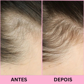 Escova de Terapia Capilar: Tratamento capilar em casa