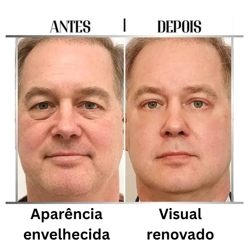 Creme Veze – Olhar Jovem em Poucos Usos