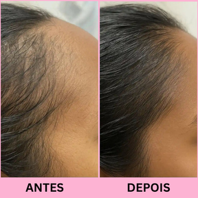 Escova de Terapia Capilar: Tratamento capilar em casa