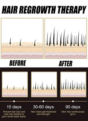 Ativador de Crescimento e Equilíbrio do Couro Cabeludo