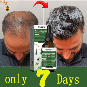 Sérum de Alecrim e Hortelã: Tônico de Fortalecimento e Crescimento Capilar