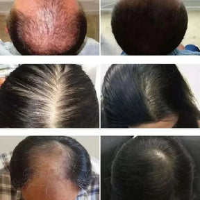 Sérum de Alecrim e Hortelã: Tônico de Fortalecimento e Crescimento Capilar