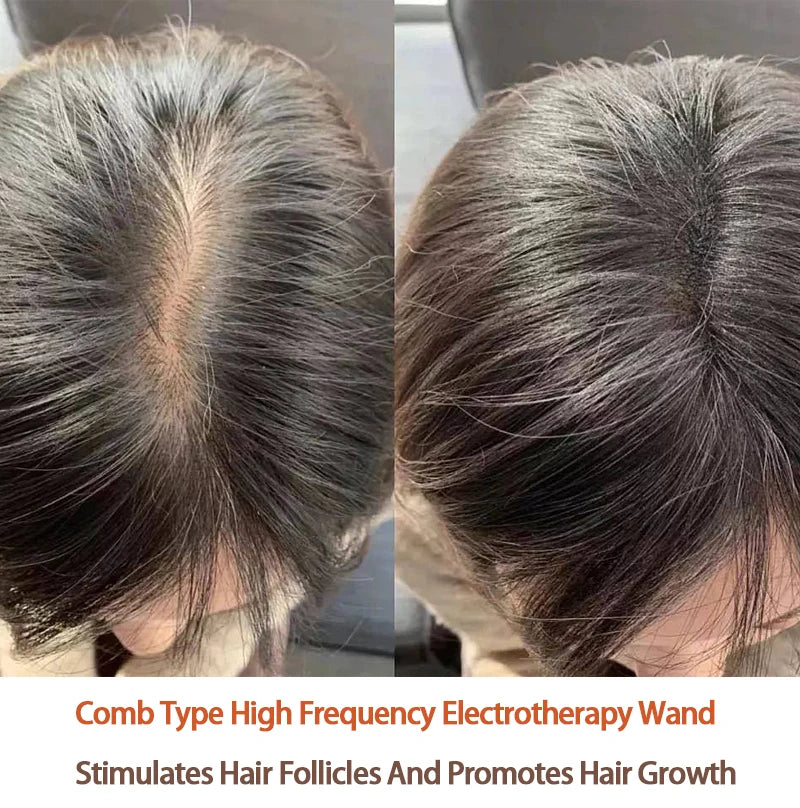 Derma Capilar™: Aparelho de Alta Frequência Profissional